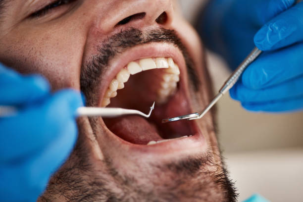 Best Emergency Treatment for Dental Infections or Abscesses in Westwood, MI